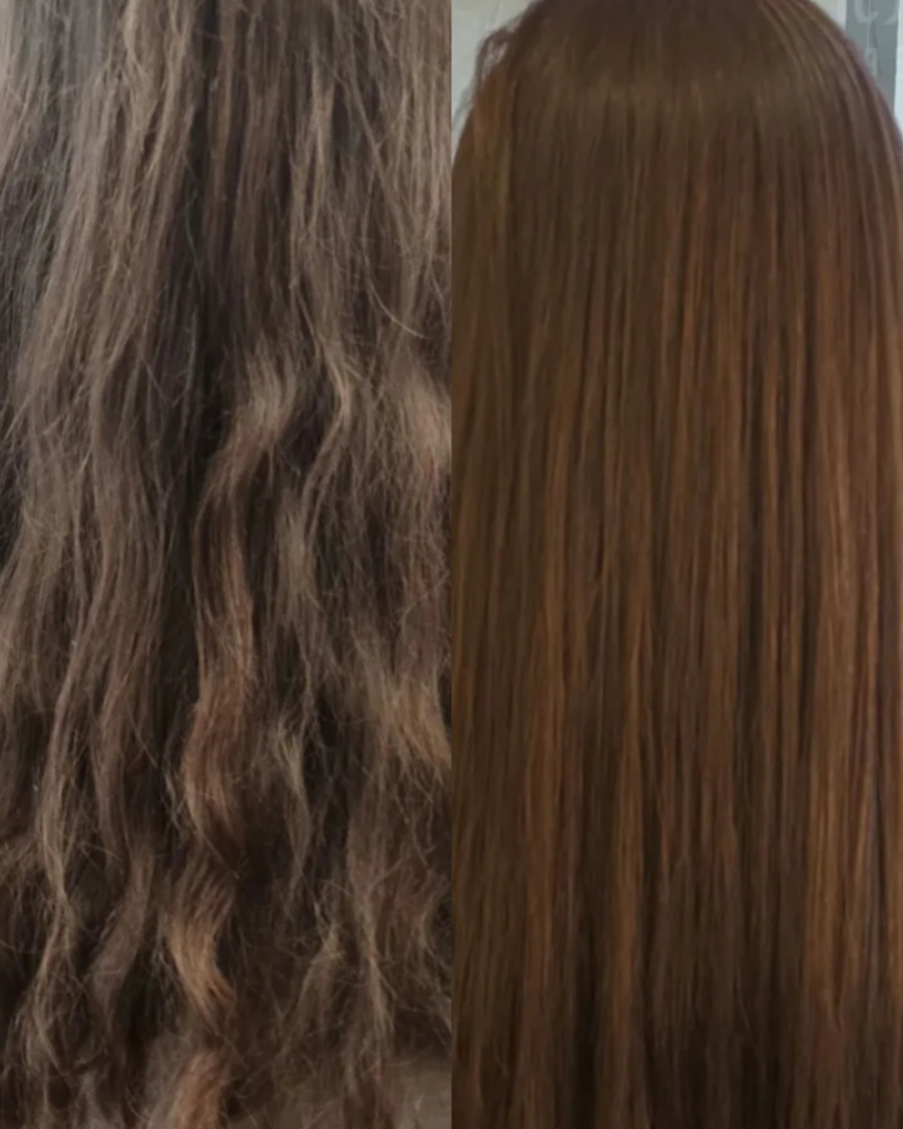 taninoplastia